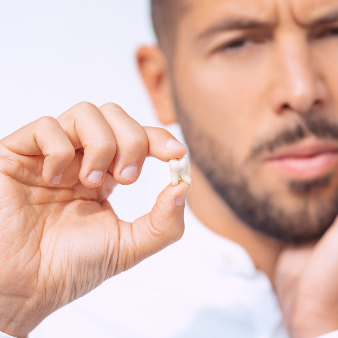 Tooth Extraction in Mississauga | General Dental Services | Cooksville Dental